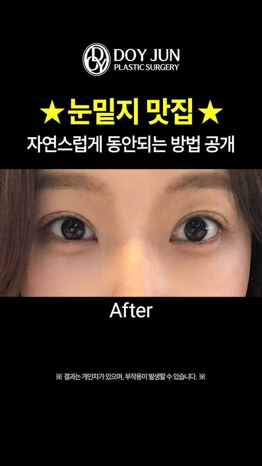 자연스럽게 동안되는 방법 공개!
